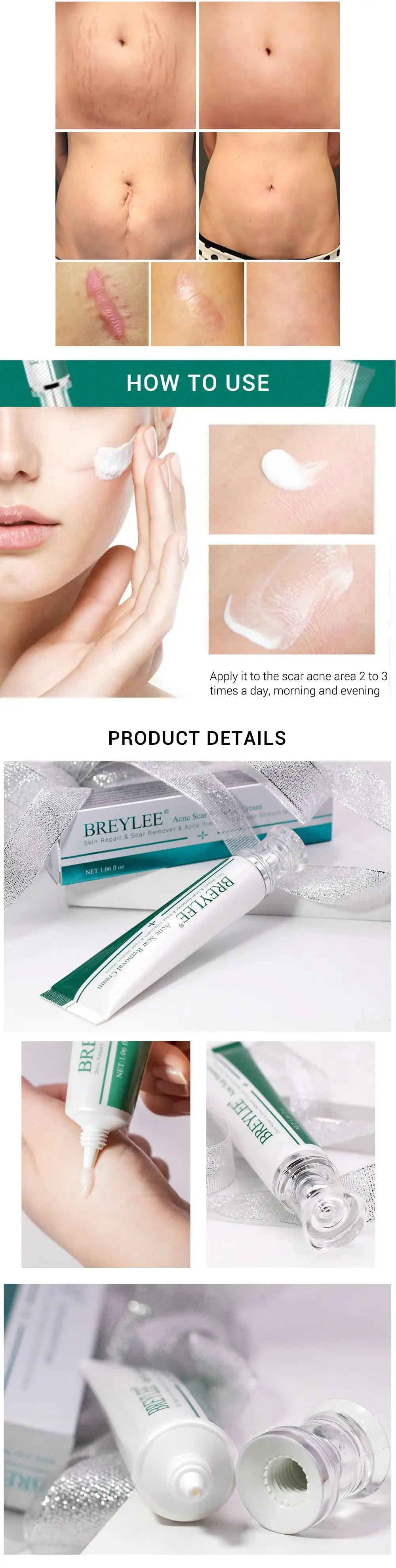 breylee scar removal cream