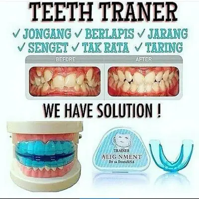Teeth Trainer Alignment Orthodontic Tooth Trainer Tool Rapat Gigi Teeth Braces