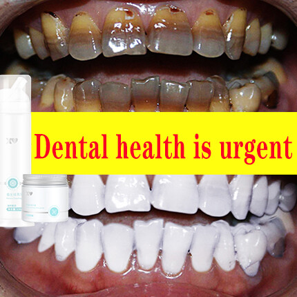 Gambar ?Greentouch?X? Teeth Beautifying Mousse Toothpaste Cleaning Powder Effective Stain Removal Plaque Removal Toothpaste Perfect Smile Dental Tools Oral Hygiene Cleaning