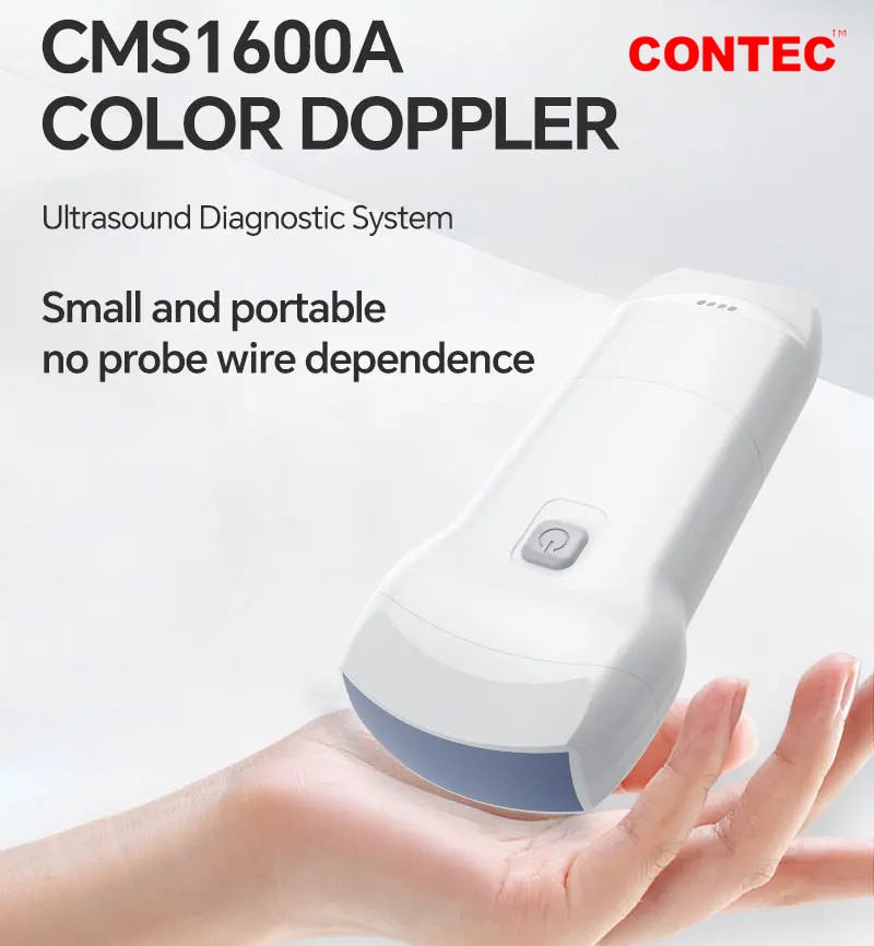 CONTEC CMS1600A 3 in 1 Wireless Ultrasound Scanner Machine Color Doppler Vascular WLAN Ultrasonic Diagnostic Systems ราคา 69,591 บาท*ส่งฟรี