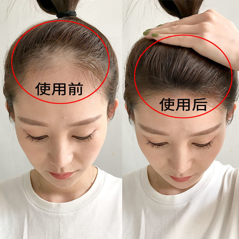 Gambar Hair Loss Shampoo Hair Care Shampoo Hair Growth Serum Hair Tonic Growth 400ml Oriental Arborvitae Leaf Essence Anti Itch