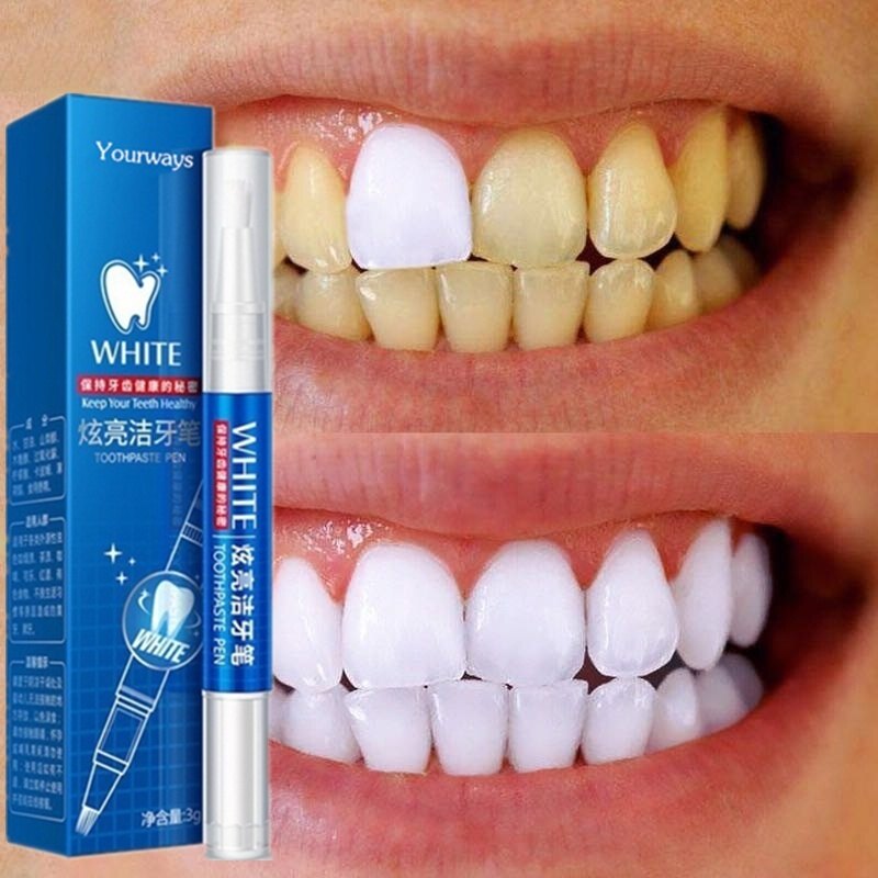 Gambar Teeth Whitening Pen pemutih gigi Perfect Smile Oral Hygiene Cleaning Serum White Tooth Essence Removes Plaque Stains Tooth Bleaching Oral Care Gel