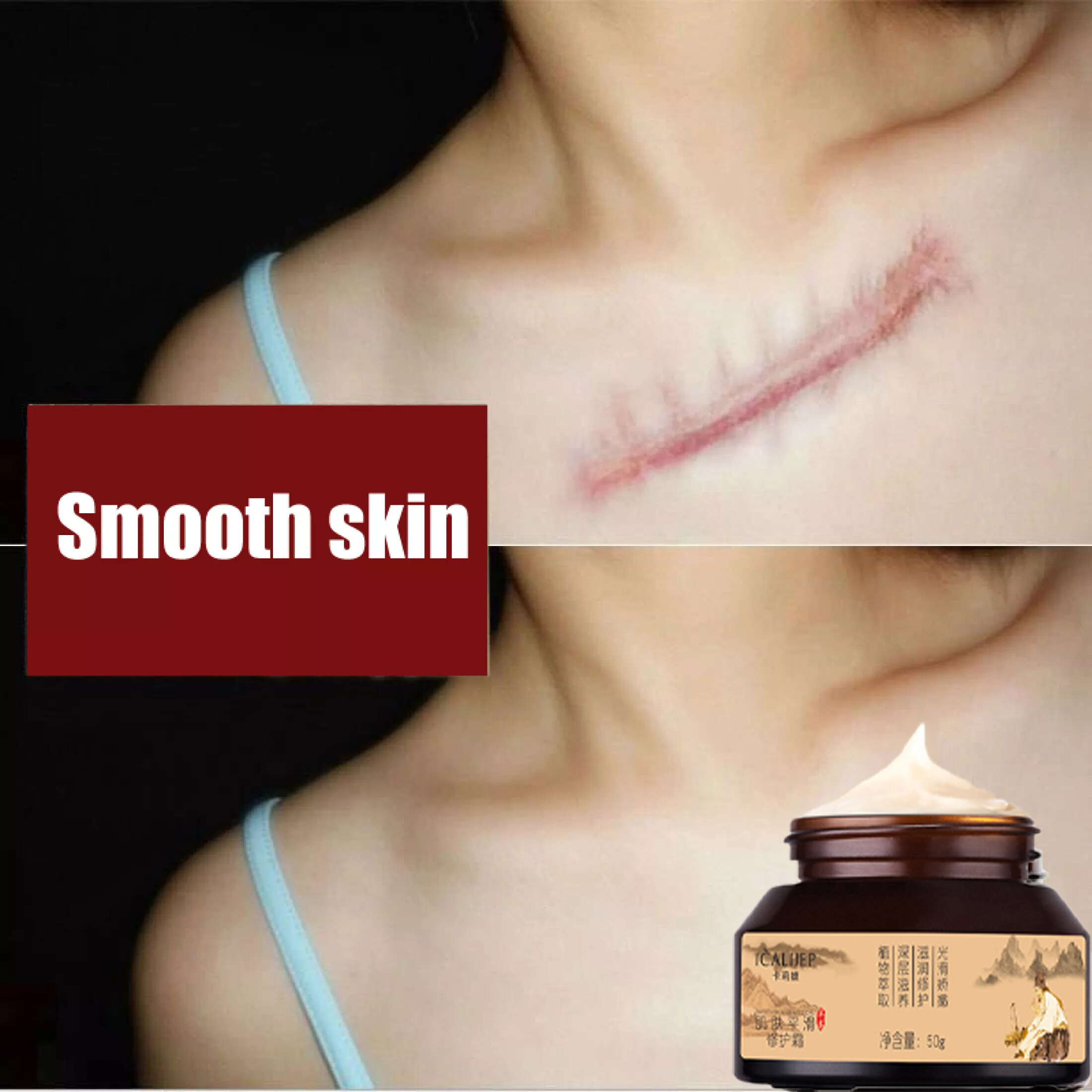 Gambar Scar Removal Cream Skin Repair Face Cream Acne Spots Acne Treatment Blackhead Whitening Cream Stretch Marks Acne Removal Treatment Cream Facial Scar Mark Lightning Oil Control Shrink Pores Moisturizer