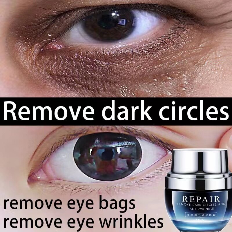 Gambar Eye cream Moisturizer cream anti aging serum night cream Eye cream for dark circle and eyebag ??  Retinol cream anti aging original Eye bag removal cream Fades Wrinkles Firming Brighten Skin