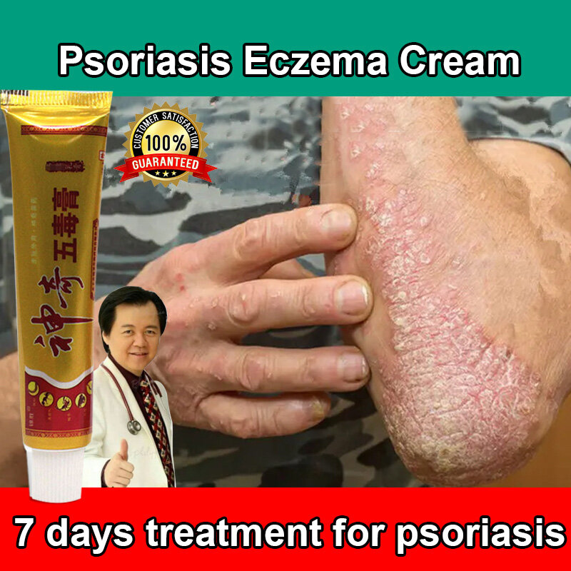 Gambar Immediate results!  Psoriasis Eczema Treatment Cream 15g For the treatment of skin allergies and tinea corporis Herbal Antibacterial Cream Eczema Ointment Ointment for Itchy Skin and Allergy Antifungal Cream Anti Itch Cream for Skin atoderma cream