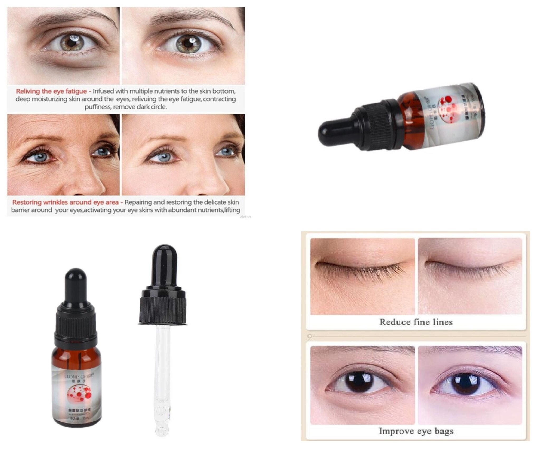 niacinamide dark circles