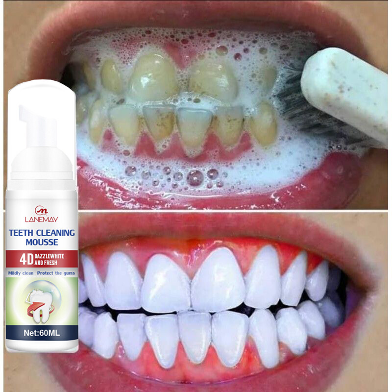 Gambar Teeth whitening mousse 60ml pemutih gigi  Prevent Cavities Remove Tartar  dental calculus   removes bad breath  fresh breath Deep clean teeth Tooth mousse Oral care  Oral Hygiene Mousse Toothpaste Whitening and Staining