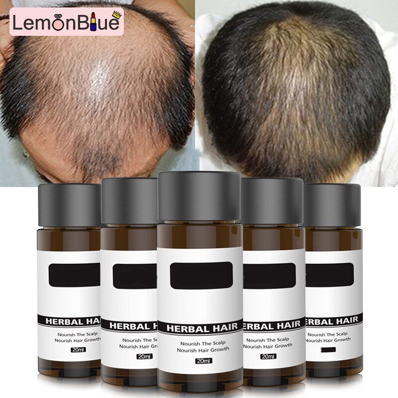 Gambar LemonBlue Ginger Germinal Essential Hair Growth Hair Nutrient Solution Natural   Fast Hair Care for Men Women 20ml