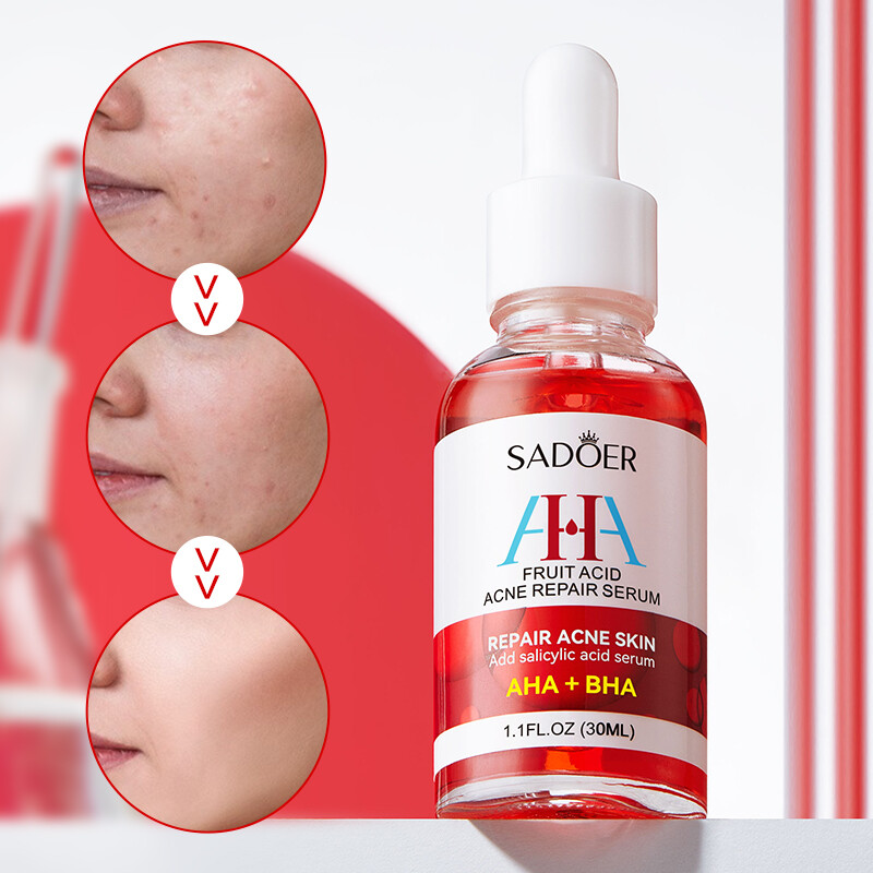 Axit trái cây loại bỏ mụn trứng cá và sửa chữa tinh chất chăm sóc da, giữ ẩm và giảm mụn trứng cá