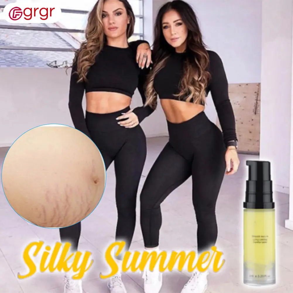 postpartum stretch mark removal