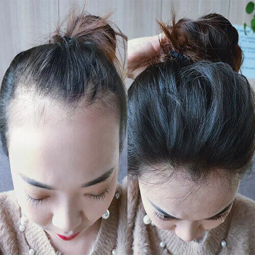 Gambar Ginger Fast Hair Growth Serum Essential Oil Preventing Hair Lose Liquid Repair Damaged Hair Conditioner Care Essence 30ML ginger essential oil