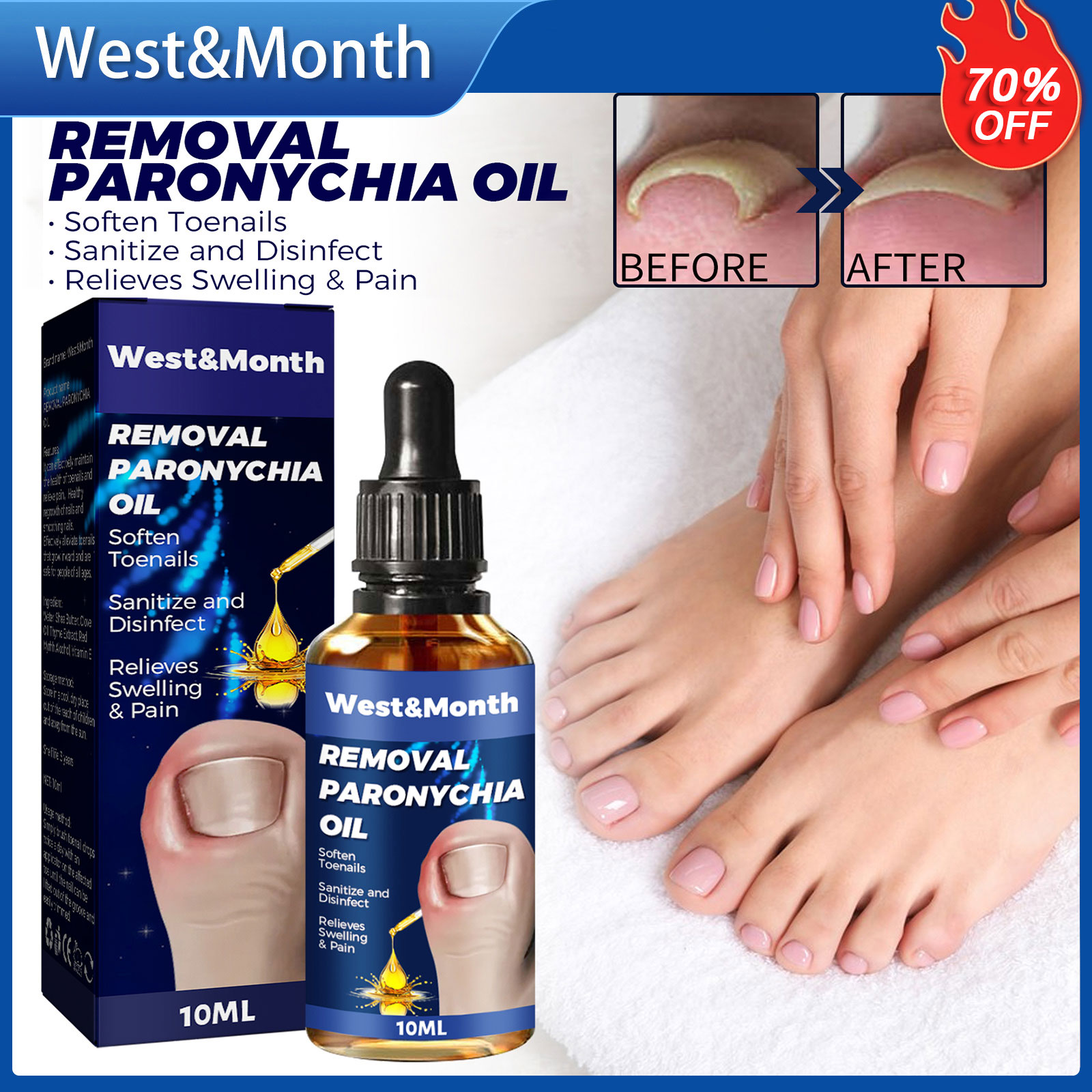 Tây & Tháng Loại Bỏ Paronychia Dầu móng chân mọc trong Điều Trị Sửa Chữa Móng Tay Chống Nấm Làm Mềm Loại Bỏ Nấm Làm Trắng Chống-Paronychia Relief Huyết Thanh chăm sóc móng (10Ml)