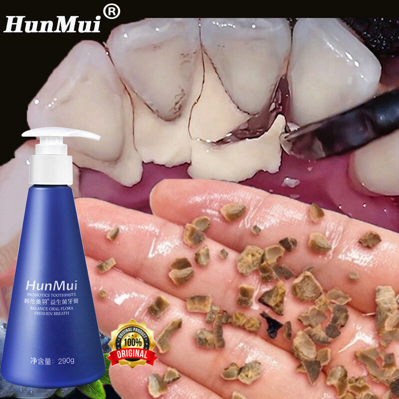 Gambar Calculus Removal Teeth Whitening Toothpaste ?290g?Toothpaste remove bad breath ubat gigi Teeth white ubat gigi ukiwi toothpaste original Tartar kuning pemutih remove stone Children Remove tartar yellow tartar stone plaque Anti decay ????