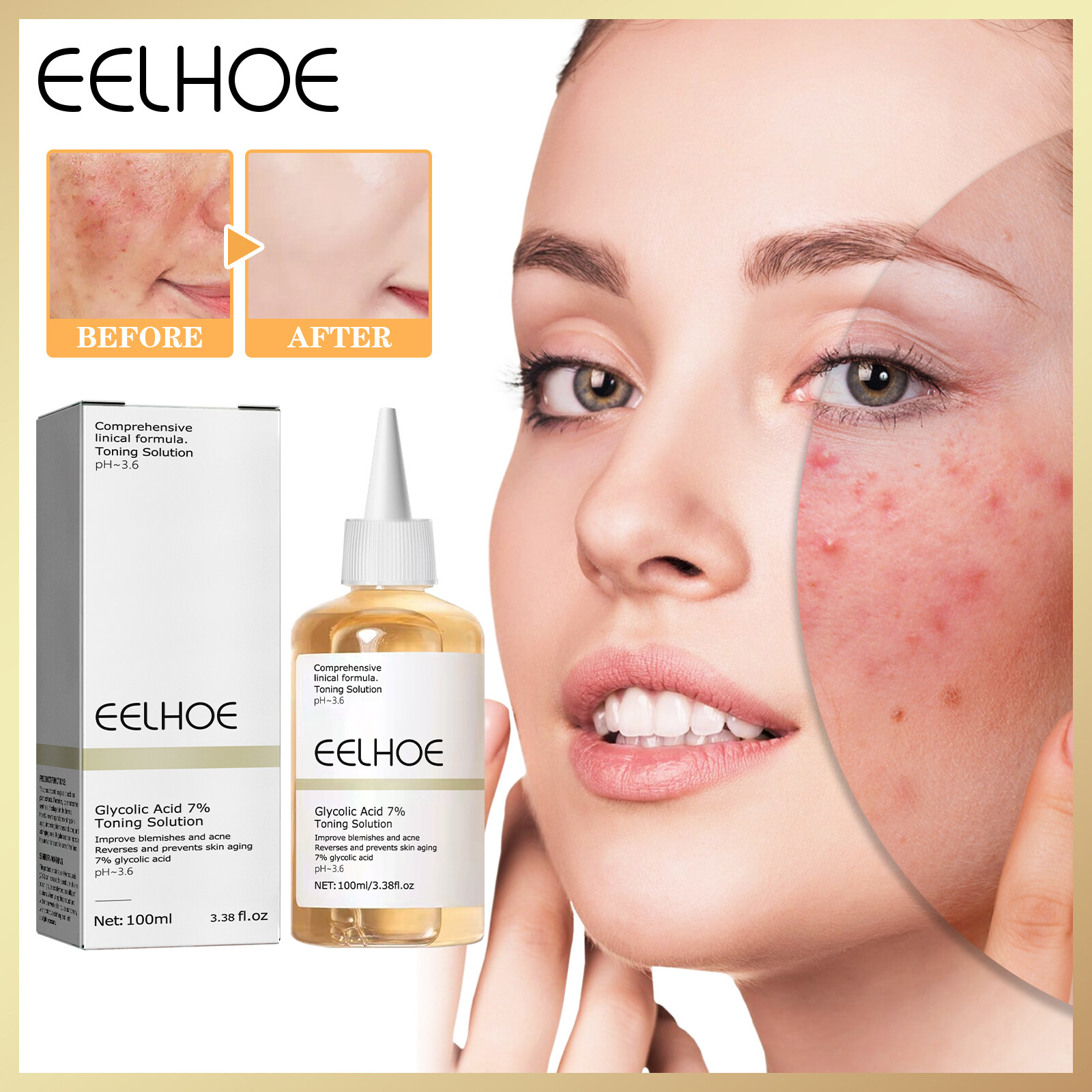 Eelhoe axit glycolic 7% Toning giải pháp làm sáng da tinh chất để loại bỏ mụn thu nhỏ lỗ chân lông sửa chữa mực mặt nhẹ nhàng tẩy da chết cải thiện tình trạng da làm sáng sản phẩm Tông da chăm sóc da mặt axit mực