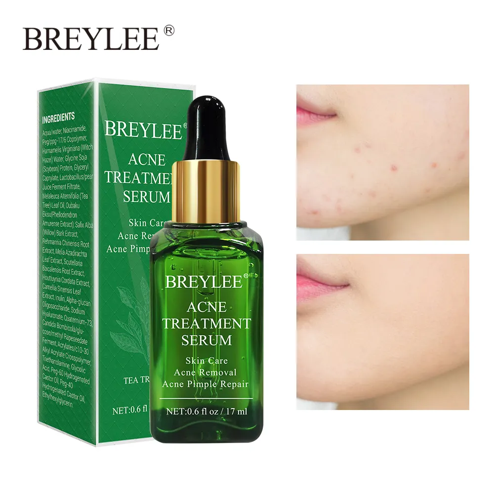 breylee scar removal cream