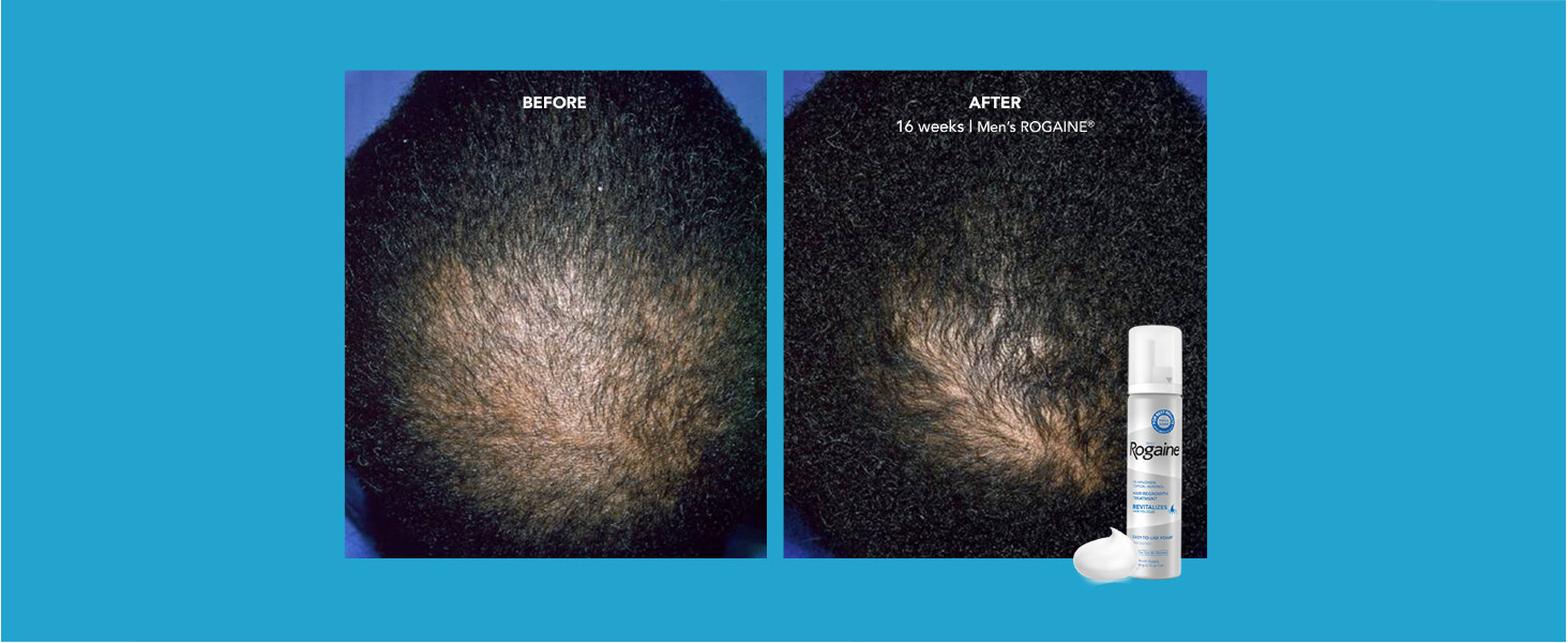 Before and After Panel 1