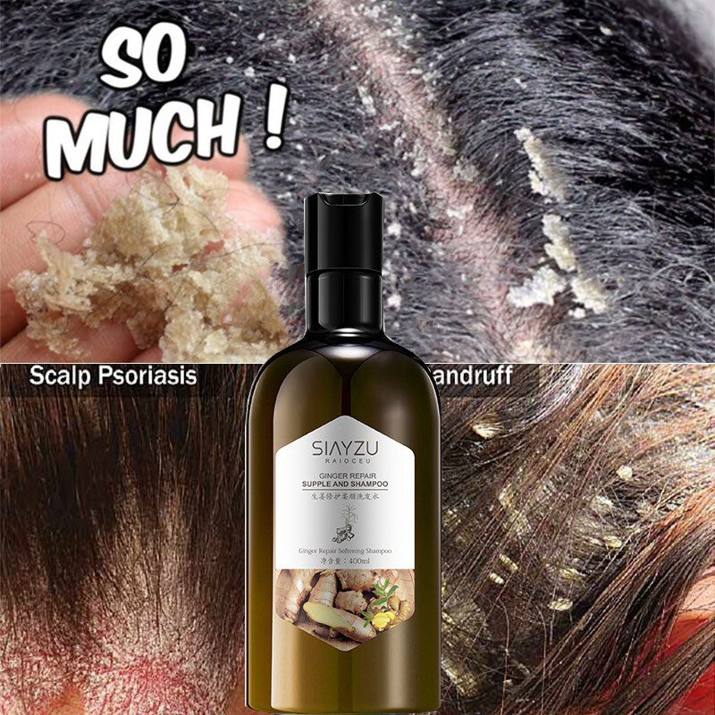 Gambar ?Special offer price?Anti Dandruff Shampoo 400ml  Ginger syampu set Anti dandruff remove mites Clean Scalp refreshing oil controlling Reduce Hair Loss   improving frizz fluffy  promote hair growth ginger shampoo