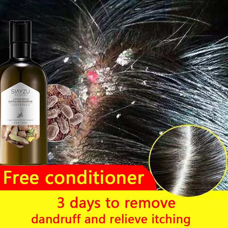 Gambar ?Ready stock?Shampoo rambut gugur Anti dandruff  Hair Care  Repair Damaged Hair