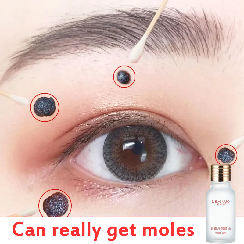 Gambar mole remover rose facial essential oil 20ml dilute melanin lighten dark spots whiten moisturize serum