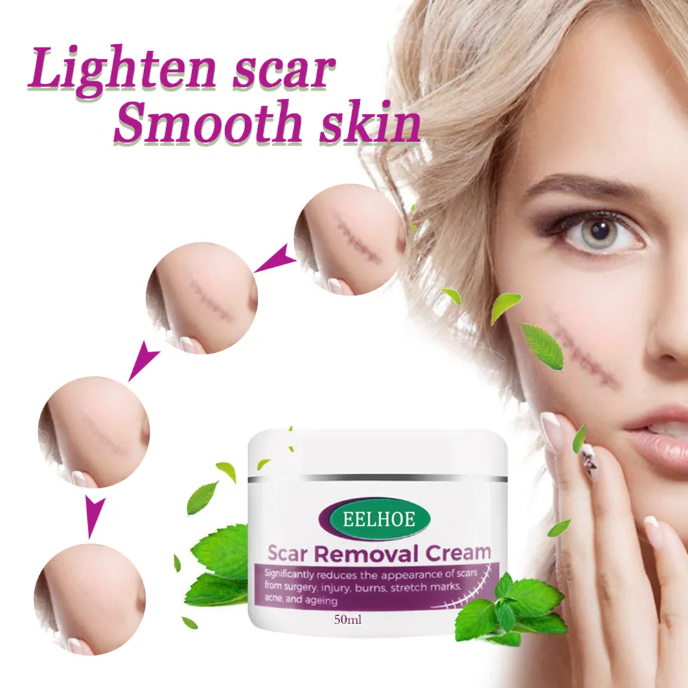 stretch marks removal cream for men