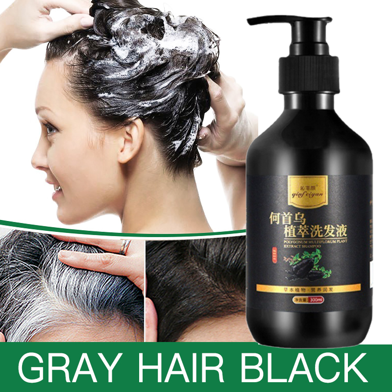 Gambar White hair to black hair Prevent hair Hair Growth Essence Hair Loss Dry Frizz Speed up Hair Growth Hair Care Anti hair Loss Shampoo Suitable for low hair volume Hair Treatment Damaged Hair Split ends Anti fungal 300 ml for men and women