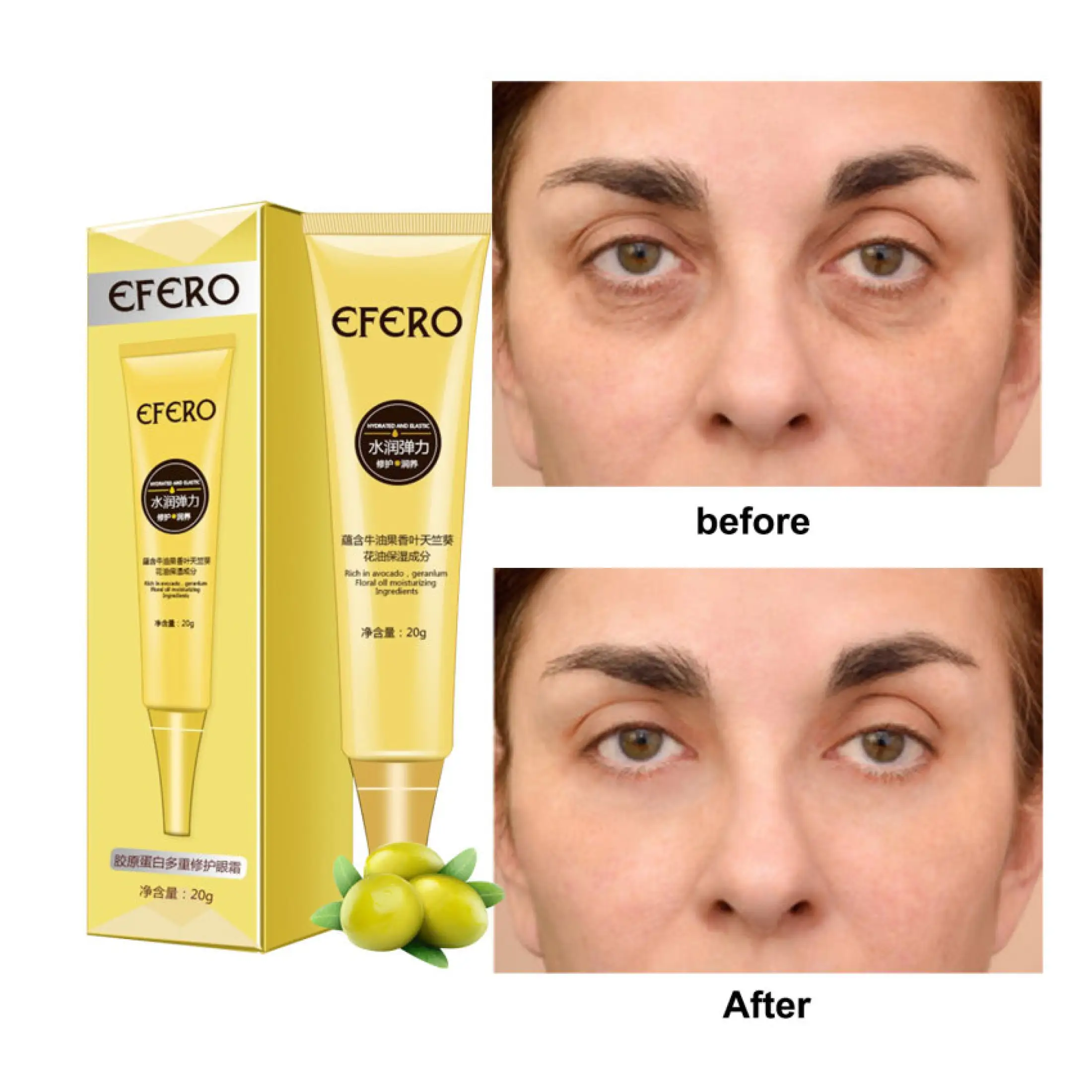 hemorrhoid cream for puffy eyes