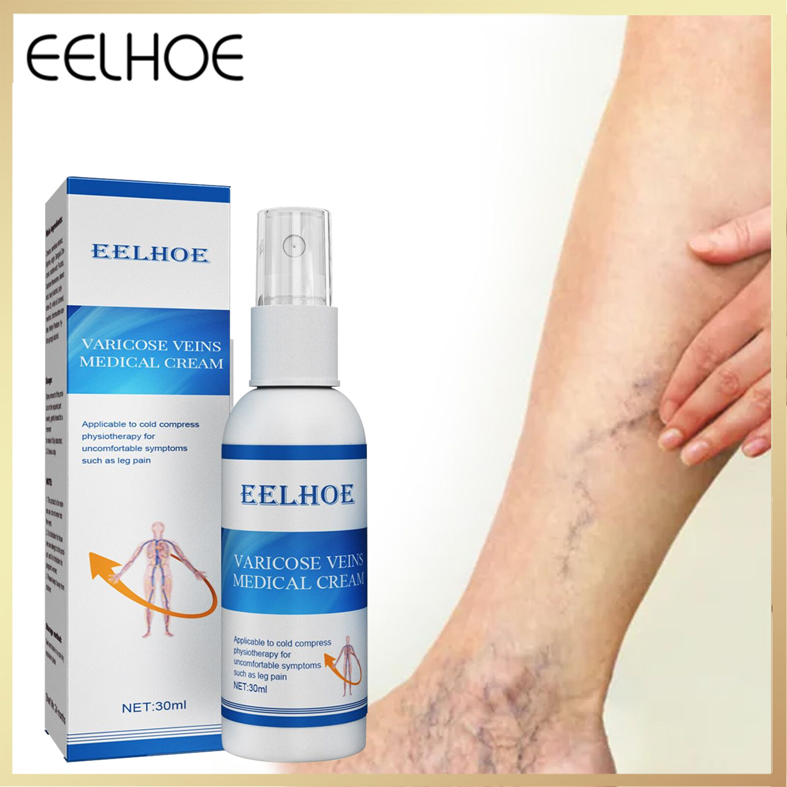 Varicose Vein Soothing Relief Spray Treatment Vasculitis Phlebitis