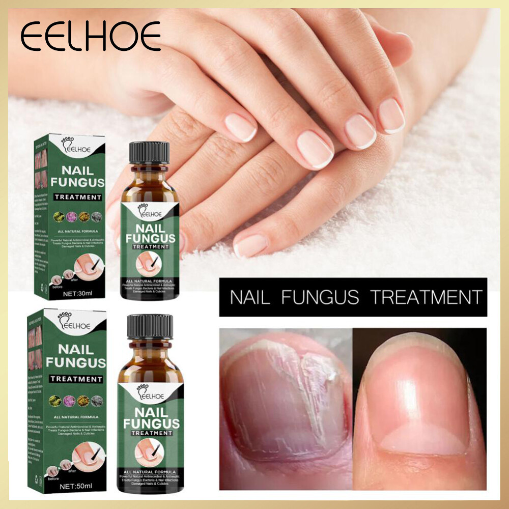 Eelhoe serum trị nấm móng gel loại bỏ nấm móng chân móng chân nấm móng paronychia dạng lỏng tinh chất chăm sóc bàn chân tay chống nhiễm trùng dung dịch chăm sóc làm dày móng chân loại bỏ lớp biểu bì kháng nấm giọt