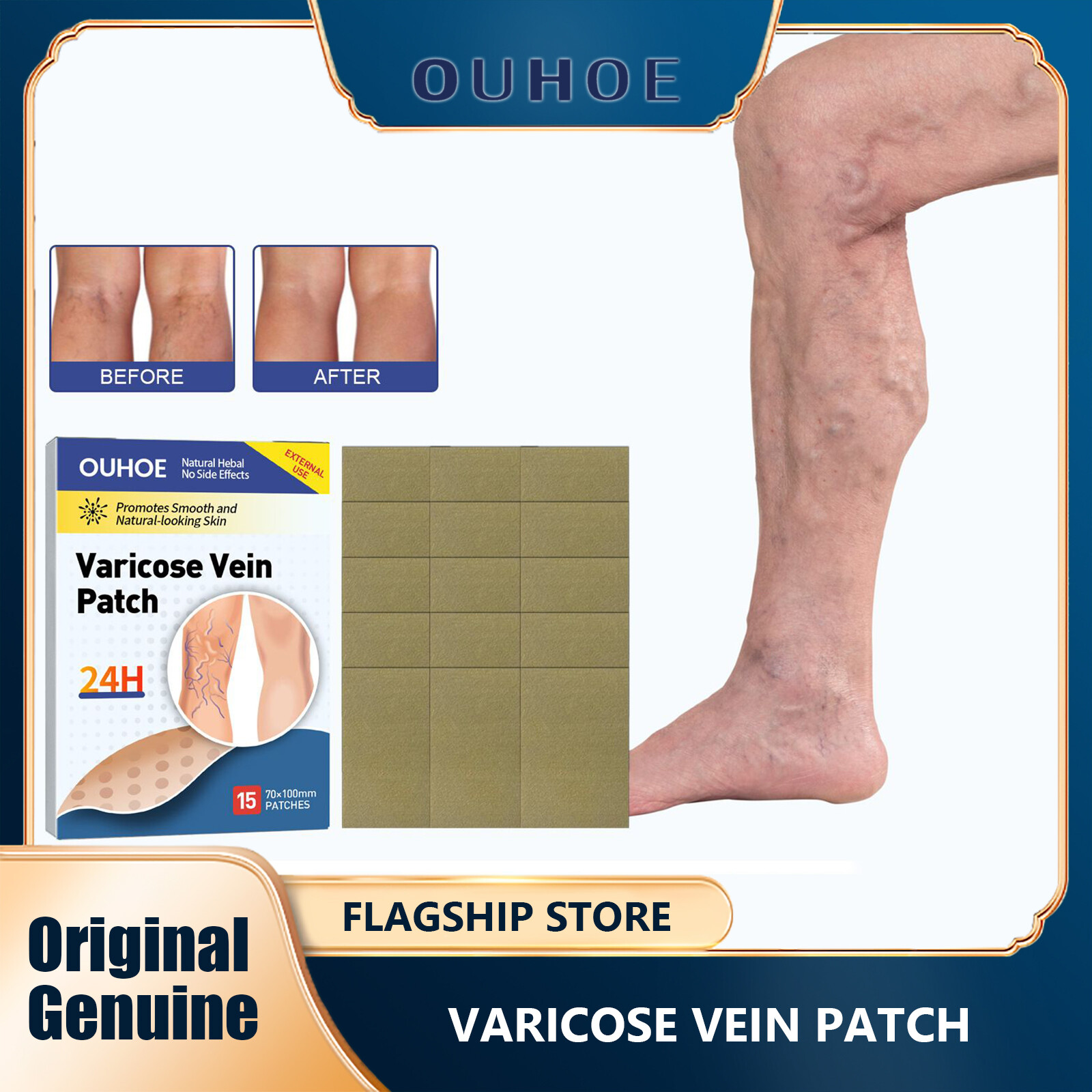 Ouhoe giãn tĩnh mạch miếng dán sửa chữa đau chân và sưng chân giun đất cải thiện tắc nghẽn mạch máu và miếng dán phồng viêm mạch viêm tĩnh mạch chân nhện mát-xa trị liệu điều trị giảm giãn tĩnh mạch s