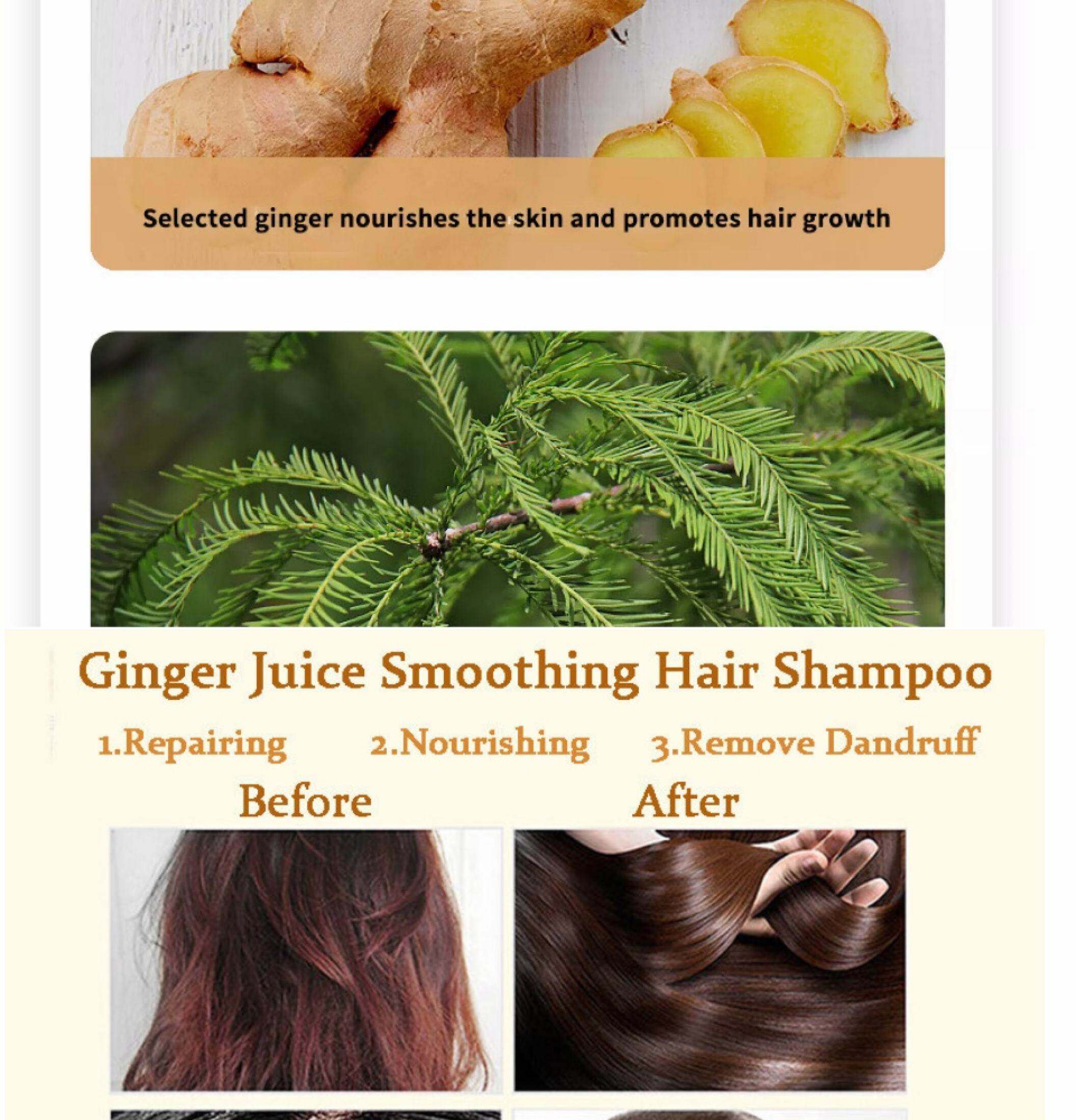 Ginger Juice Hair Growth Shampoo Man & Woman Bald Regrowth Hair Relieve  Itchy Scalp Dandruff Anti Hair Dense Hair Growth Healthy Nourishing Hair  Roots Shampoo | Lazada