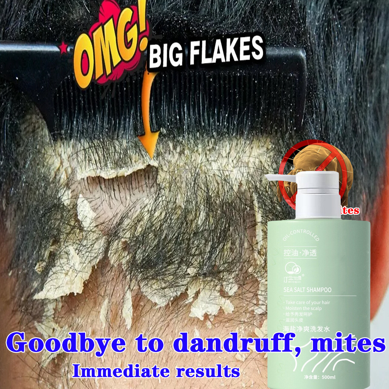 Gambar Antidandruff antipruritic hair follicle mites remove red   swollen hair follicles dandruff itching control oil on the scalp repair hair follicles improve frizzy hair Anti Oil Long lasting fragrance Anti Dandruff Shampoo 500ml
