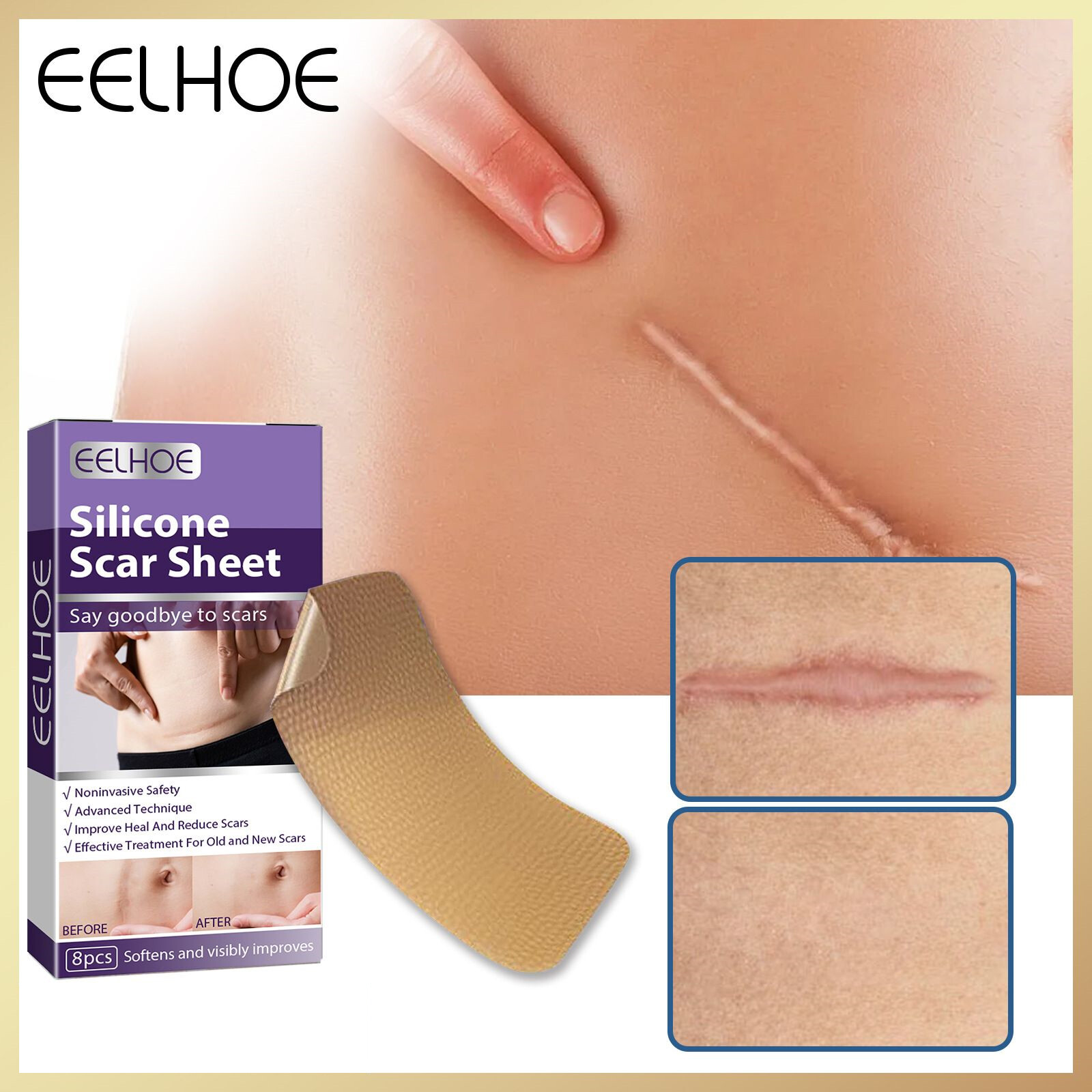  Eelhoe Miếng Dán Vết Sẹo Bằng Silicon Băng Keo Silicon Tự Dính Phẫu Thuật Hiệu Quả Miếng Dán Trị Liệu Cho Mụn Trứng Cá Chấn Thương Vết Bỏng Vết Sẹo Miếng Dán Trị Liệu Sửa Chữa Da Cho Mụn Trứng Cá Chấn Thương Vết Bỏng Vết Sẹo Điều Trị Vết Sẹo Sửa Chữa Da H 