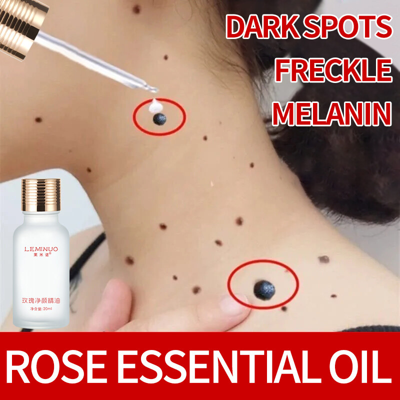 Gambar Dark Spots Remover Facial Rose Essential Oil 20ml Vitamin E Oil Lighten Melanin Whitening Hilangkan Kutil Serum
