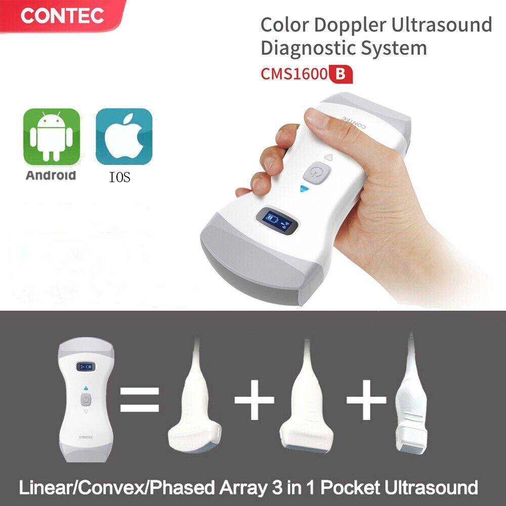 ContecMed CMS1600B Pocket Color Doppler Laptop ultrasound scanner Convex Linear Cardiac probes Ultrasonic Diagnostic Systems ราคา  79,200 บาท*ส่งฟรี