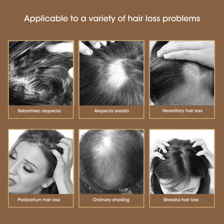 Serum dưỡng tóc Trái nhàu giúp kích thích mọc tóc an toàn từ thiên nhiên