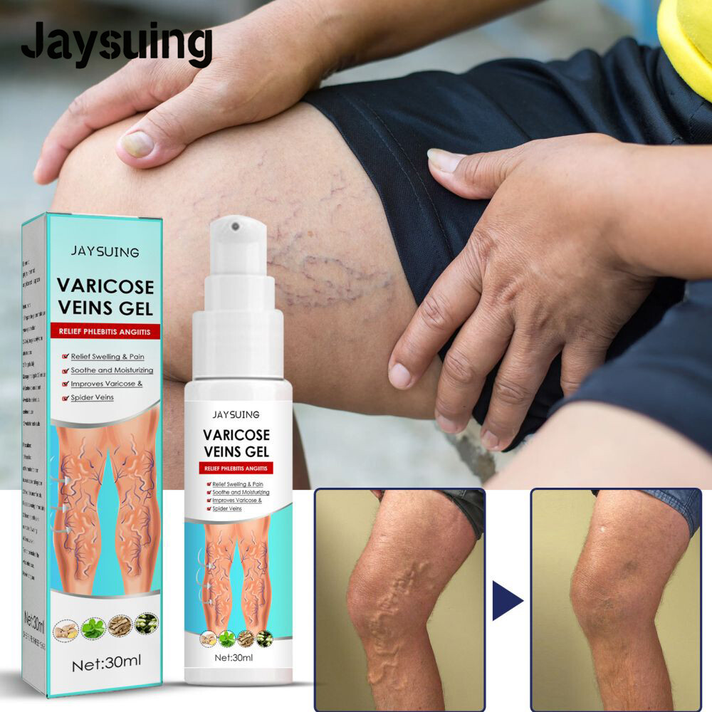Jaysuing Gel Loại Bỏ Giãn Tĩnh Mạch Thuốc Mỡ Viêm Mạch Cải Thiện Hiệu Quả Giãn Tĩnh Mạch Giảm Đau Chăm Sóc Tĩnh Mạch Phẳng