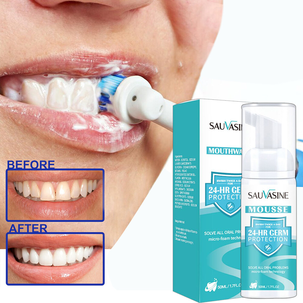 Kem đánh răng làm trắng răng sauvasine với chất tẩy vết bẩn và kiểm soát