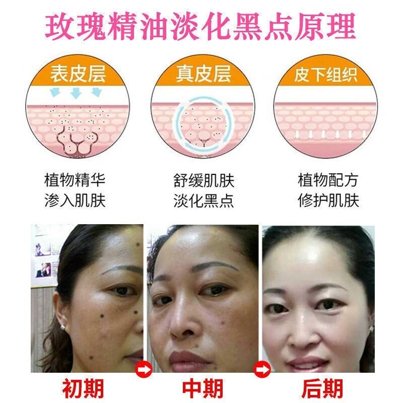 Gambar [nanjing tongrentang] point water painlessly remove nei artifact non trace repair facial oil removing and point to black spots