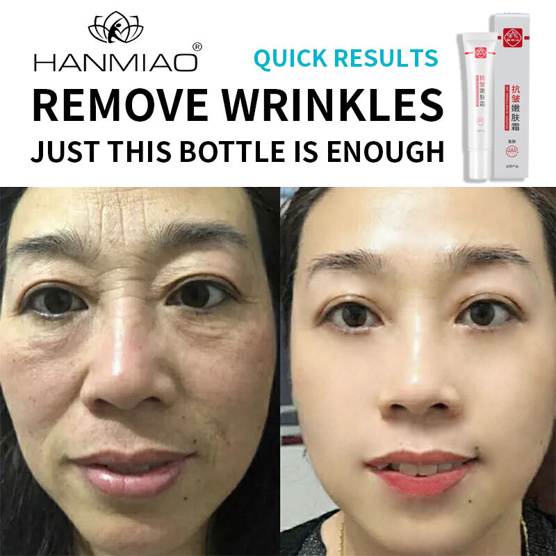 Gambar [ALL NATURA]Anti wrinkle Cream Anti aging Cream 20g ??? Dark Spot Remover Moisturizing Lifting and Firming Skincare Mild and Not Irritating acne treatment wrinkle remover make the skin elastic