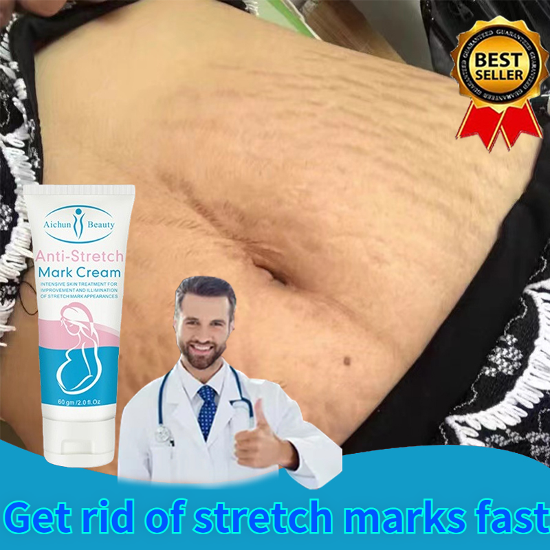 Gambar ?100% ORIGINAL?Anti Stretch Mark Cream Pregnancy Scar Removal Repair Cream Stretch Marks And Scar Removal Scar Care?Eliminate obesity lines and growth lines?