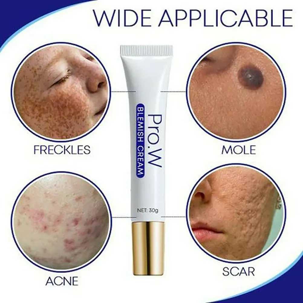 blemish whitening cream
