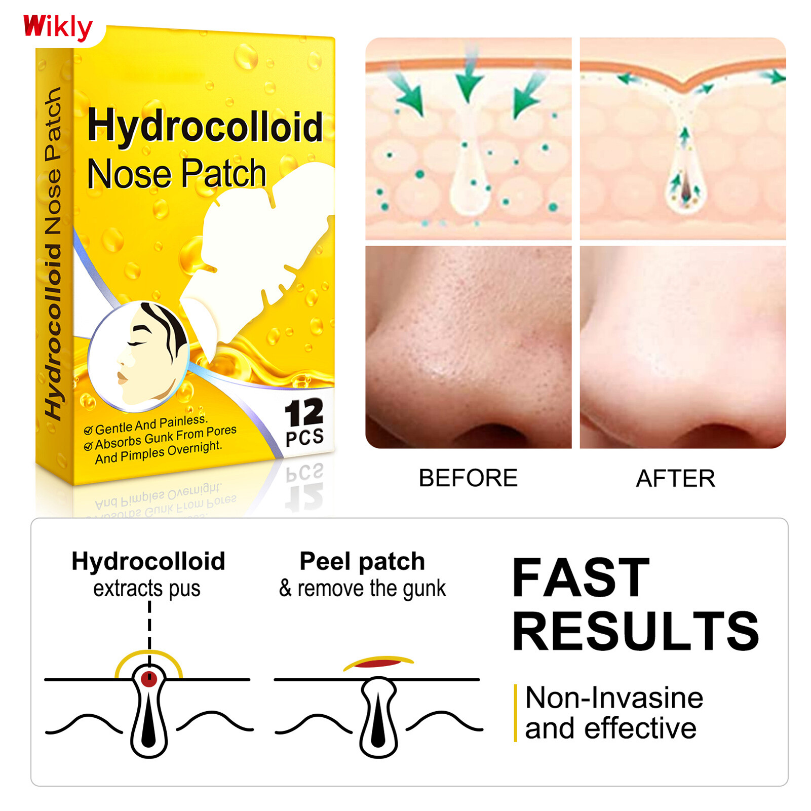 Gambar Wikly 12 Pcs Pimple Absorbing Cover Skin Care Forehead Nose Chin Clean Patches for Face Nose Chin Pore