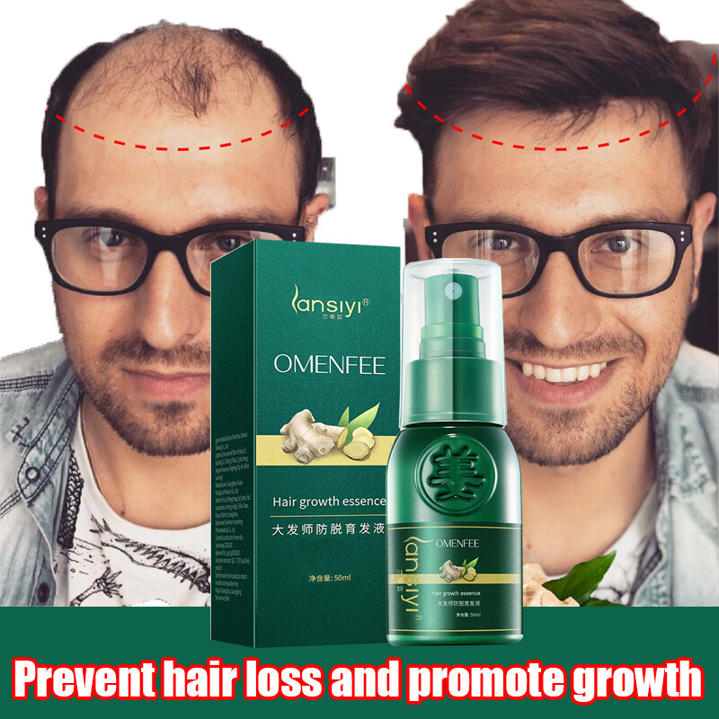 Gambar Anti hair loss spray 30ml 50ml Hair growth for men and women  Fast Hair Growth Hair treatment Stabilize hair roots  Nourish hair follicles initial stock solution Easier to absorb grow hair Thick hair Strong hair roots Hair care hair tonic liquid
