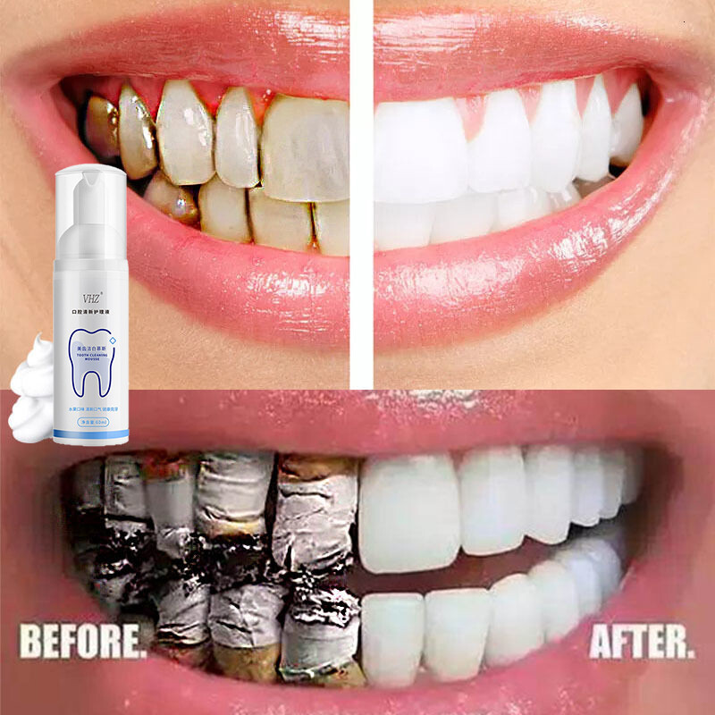 Gambar Teeth Whitening Mousse Clean Oral Hygiene Whiten Teeth Remove Plaque Stains Fresh Breath Oral Hygiene Dental Tools Toothpaste Whitening and Staining 60ml