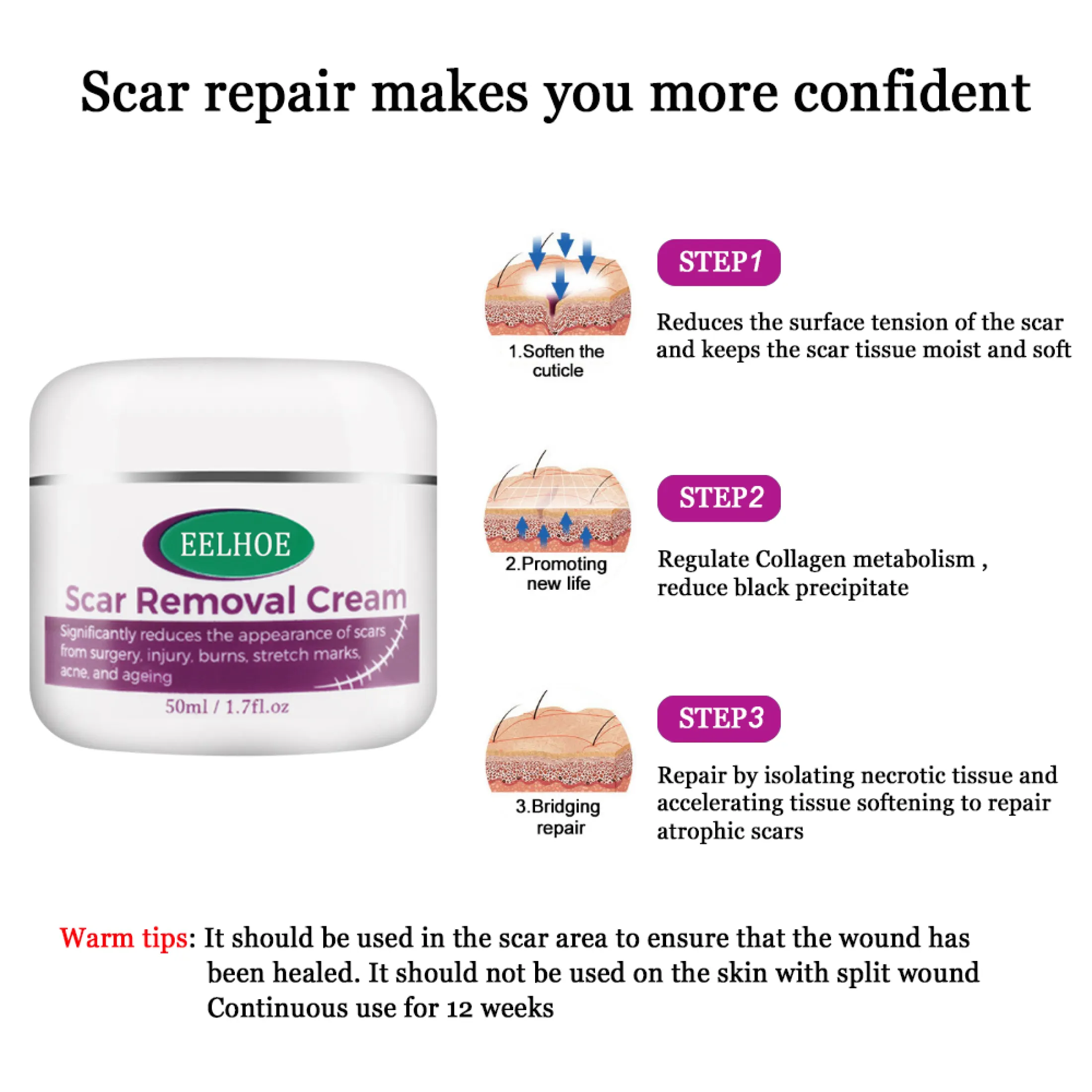 eelhoe scar removal cream