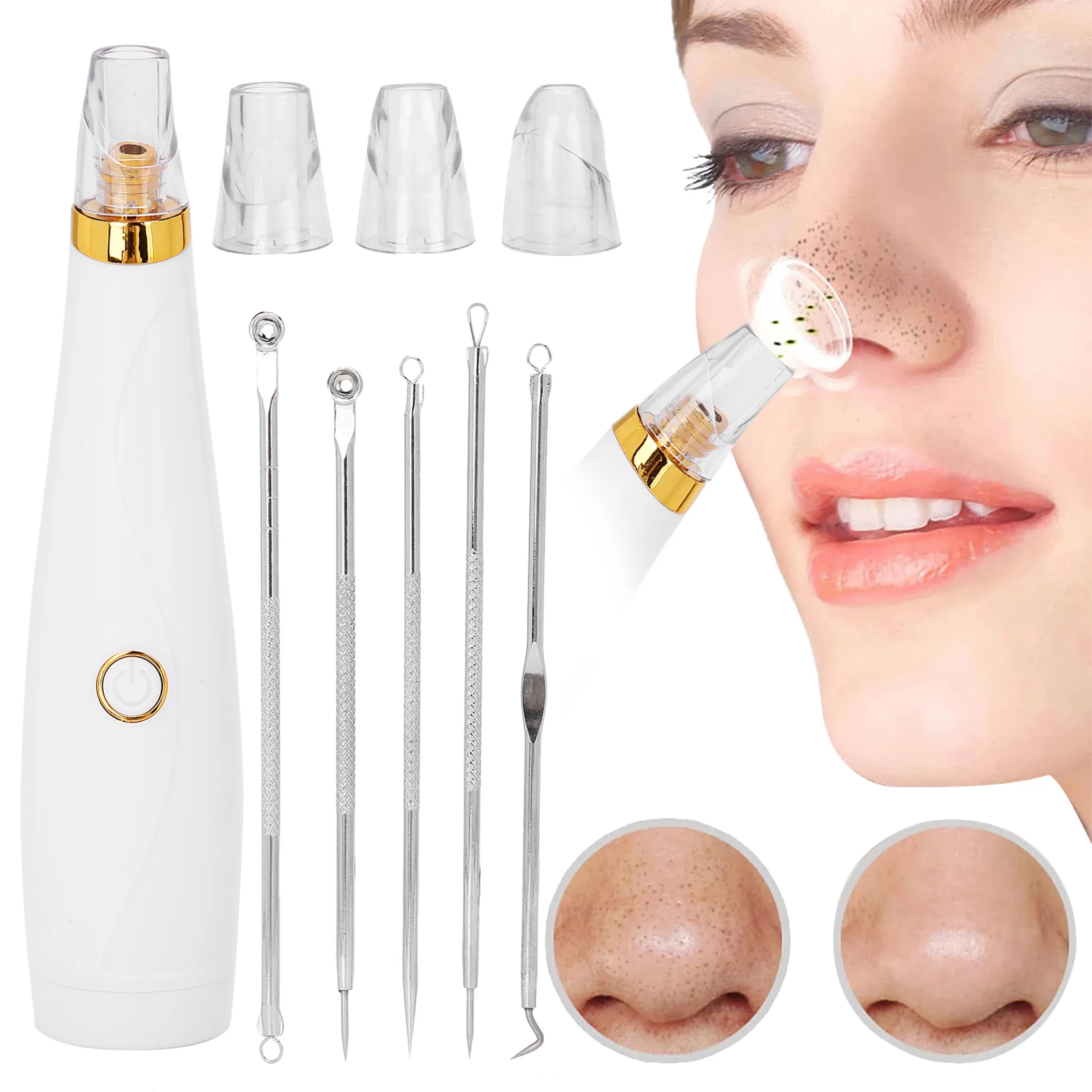 blackhead remover for sensitive skin