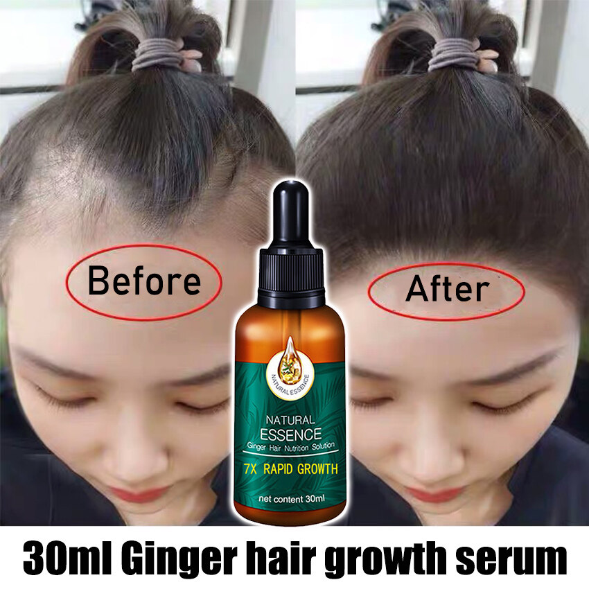 Brand new Hair Growth Serum 30ml Anti Preventing Hair Loss Alopecia Liquid