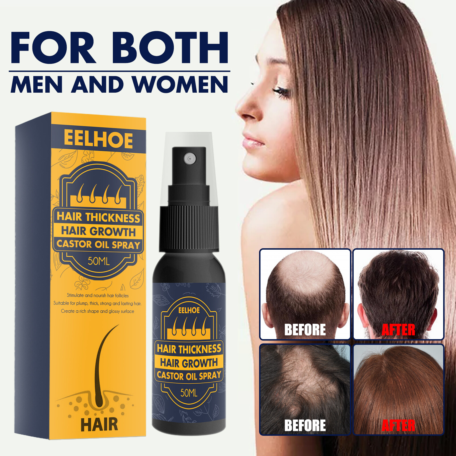 Gambar Eelhoe Castor Oil Hair Growth Spray Treatment Hair Loss Repair Damaged Hair Care For Men Women Hair Fast Growing Suitable For All Hairstyles?50ml?