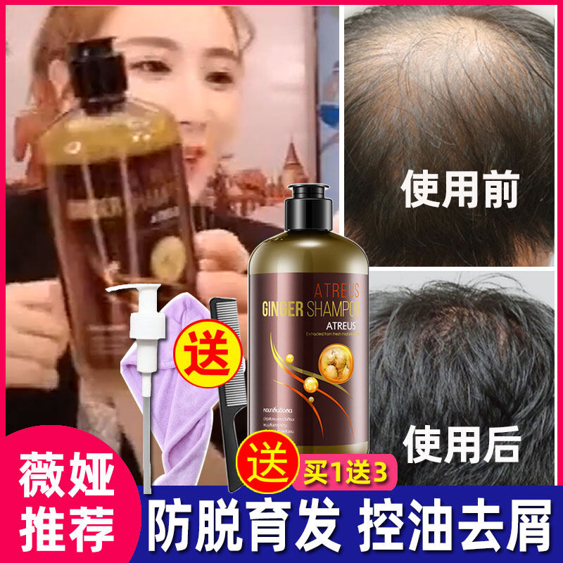 Gambar Thailand atreus ginger shampoo anti hair loss growth growth hair strong root maintenance ranking first authentic