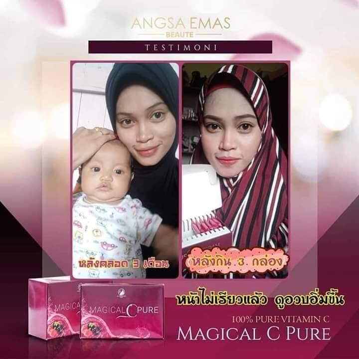 Magical C Pure Lazada Buy Sell Online Whitening With Cheap Price Lazada